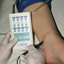 Dopplerdruckmessung der Fußarterien